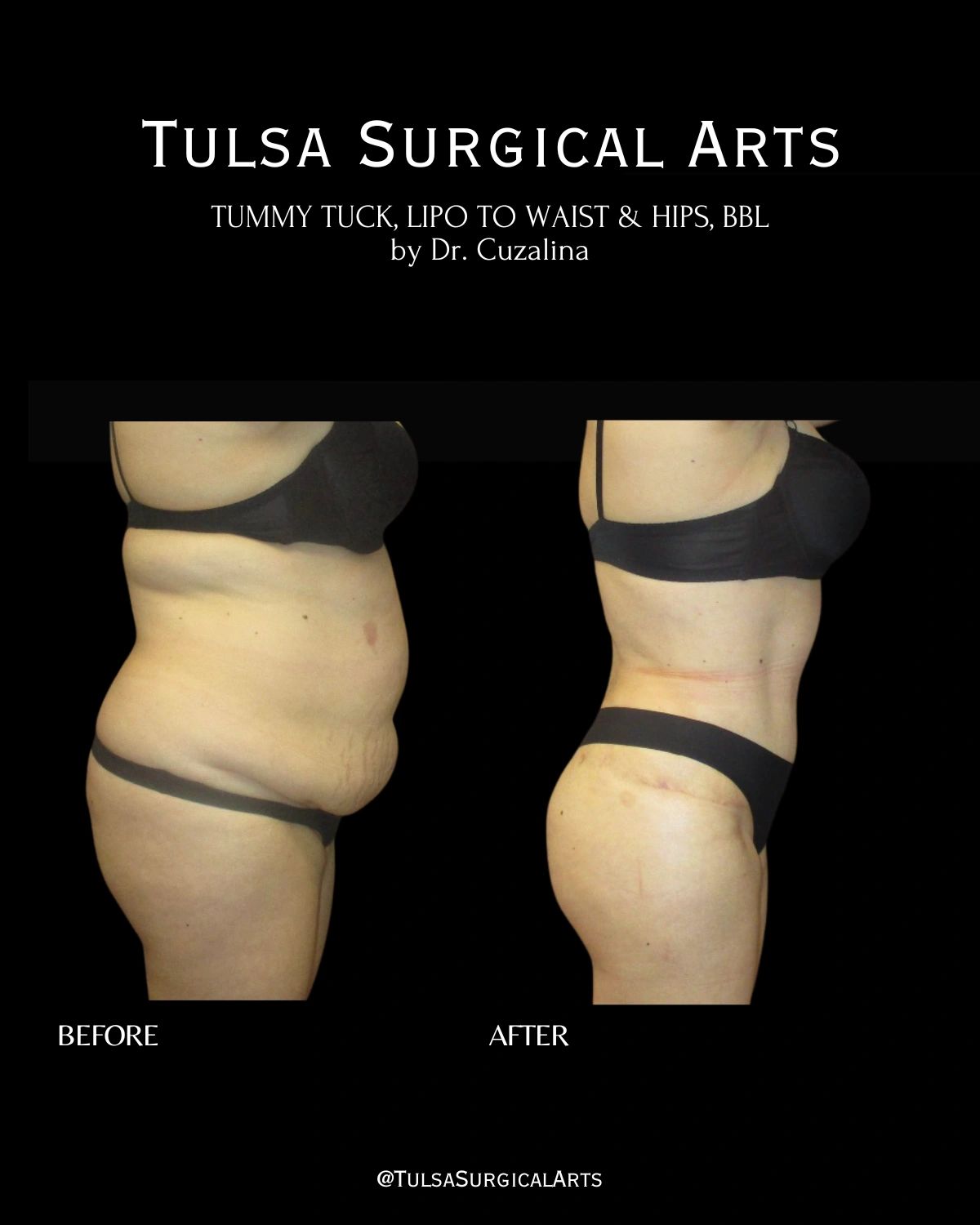 glp-1 iowa America Has a New GLP-1 Playbook