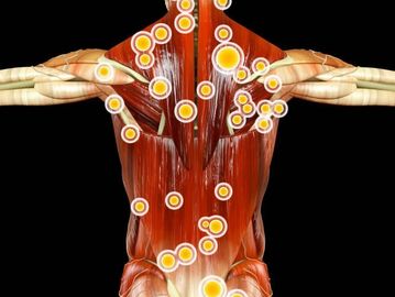 Trigger point Therapy

Receive muscular relief with targeted Trigger point therapy.  This therapy re