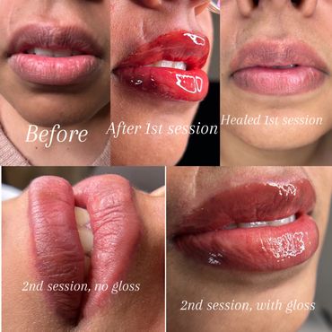 Lip blushing, before and after, dark lip neutralization, permanent makeup, cosmetic tattoo 