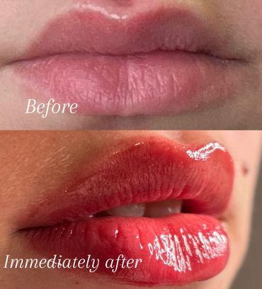 Before and after photo of lip blushing for permanent makeup, a form of Cosmetic Tattooing. 