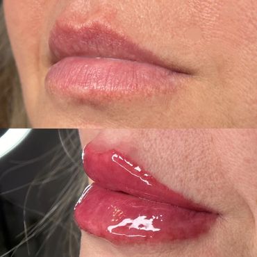 Before and after photo of lip blushing for permanent makeup, a form of Cosmetic Tattooing. 