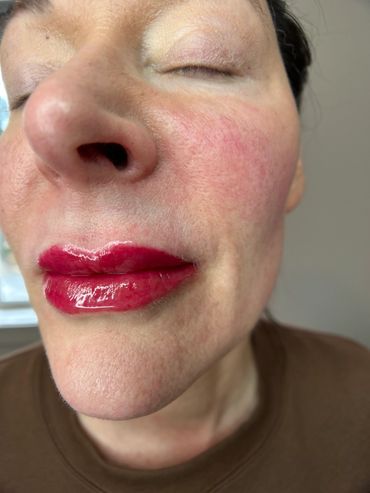 Lip blushing, before and after, dark lip neutralization, permanent makeup, cosmetic tattoo 