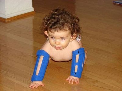 Pediatric Medical Solutions - Baby Arm Restraints, Arm Immobilizers