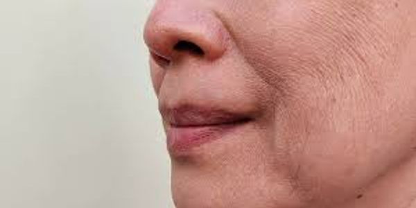 Close-up of a person's lower face showing natural skin texture and lips.