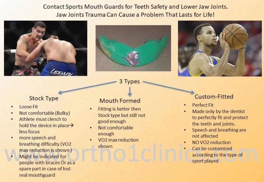 Differences between Sports Guards and Night Guards