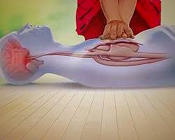 Illustration of CPR showing chest compressions and brain focus.