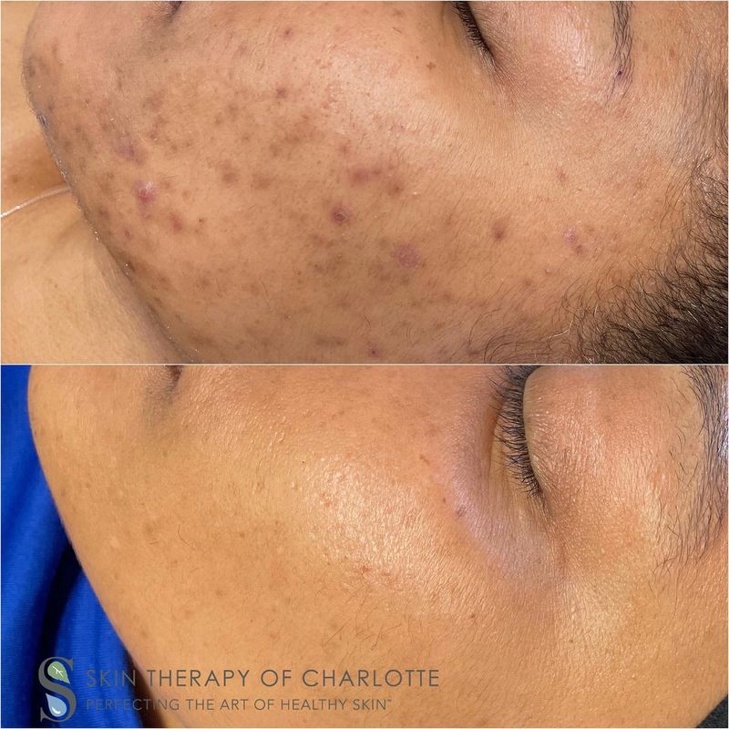 Skin Therapy Of Charlotte Llc