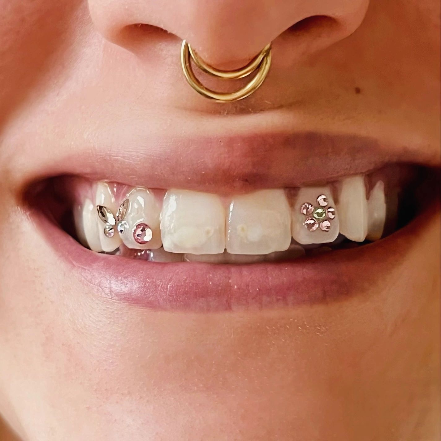 Custom Tooth Gems 