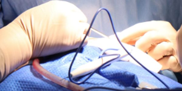 Medical professionals performing a surgical procedure.