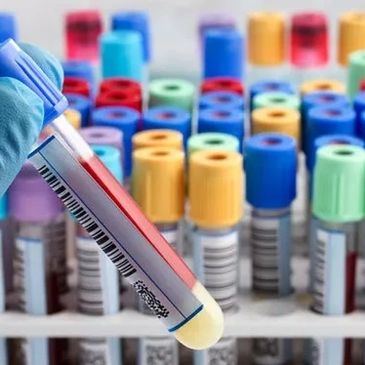 Test tubes for blood samples, being held by a phlebotomists hand,