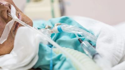 Home ICU setup service in Hyderabad with trained nurses