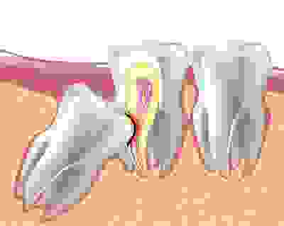 Oral Surgery | Artisan Smiles