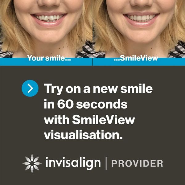 Try how Invisalign might work for you