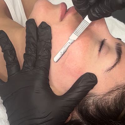 A person receiving a facial treatment with a razor by a gloved professional.