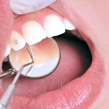 Couverture Capuche Dentiste - Cadeau Original Assistant Hygiéniste - Taille Unique