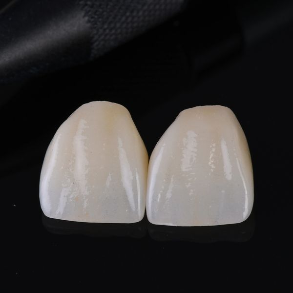 Two dental veneers placed on a reflective black surface.