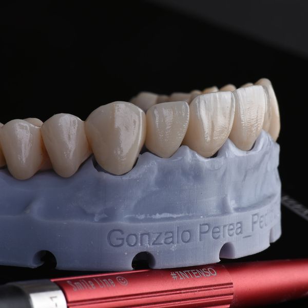 Close-up of dental prosthetic teeth on a gray mold with a red tool beneath.