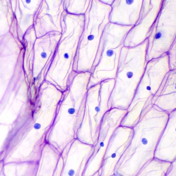 Cytology is the exam of a single cell type, as often found in fluid specimens. It's mainly used to diagnose or screen for cancer.