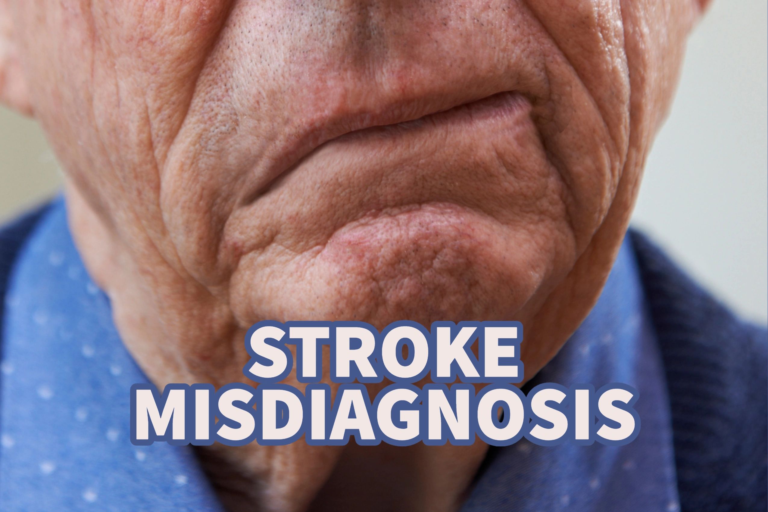 Stroke Misdiagnosis and Medical Malpractice