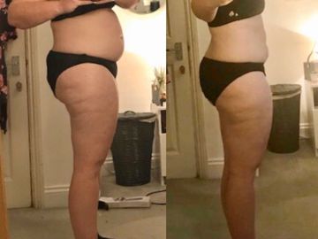 Lady showing before and after fat loss results 