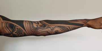 Full Arm Laser Tattoo Removal