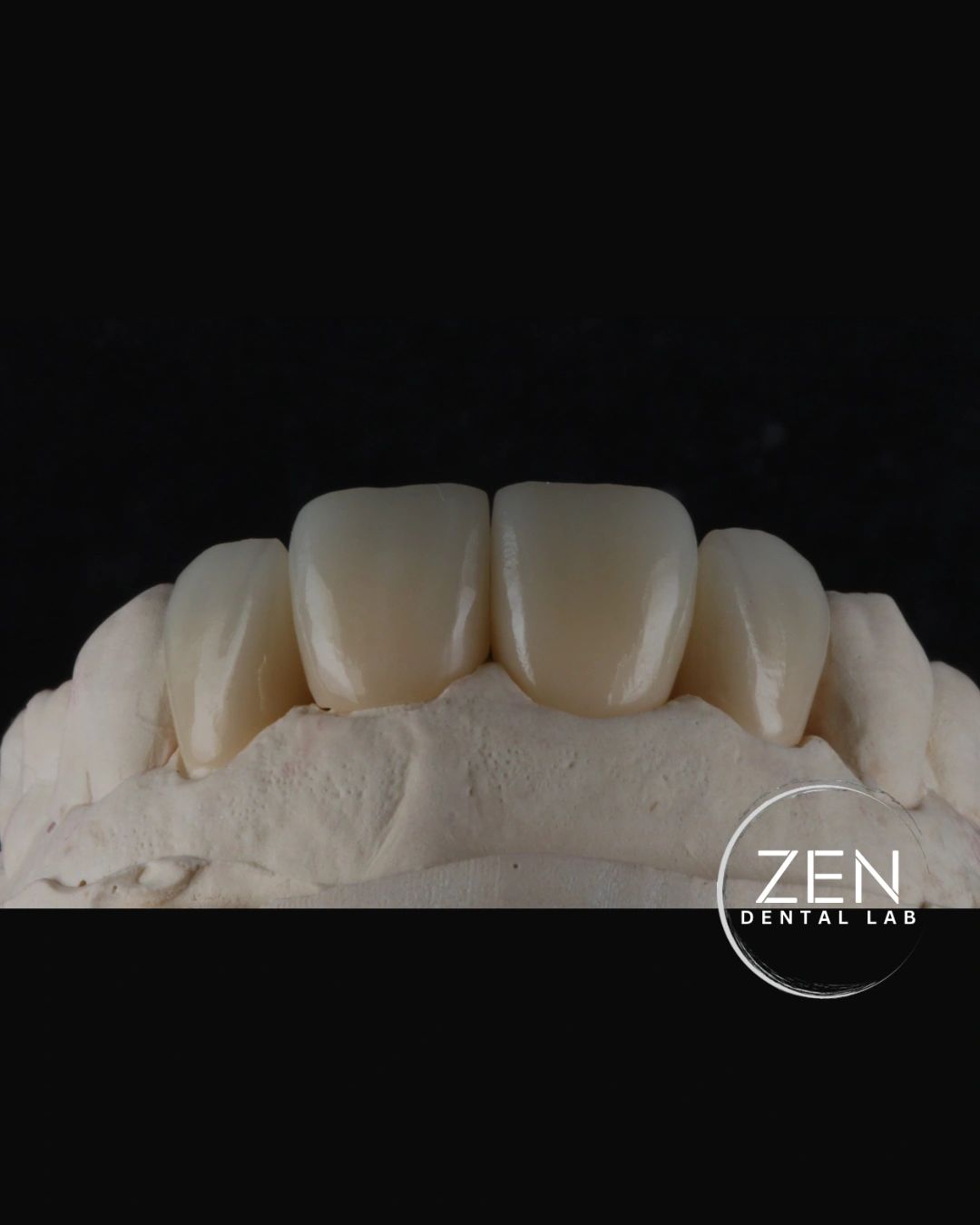 Close-up of dental crowns on a mold.