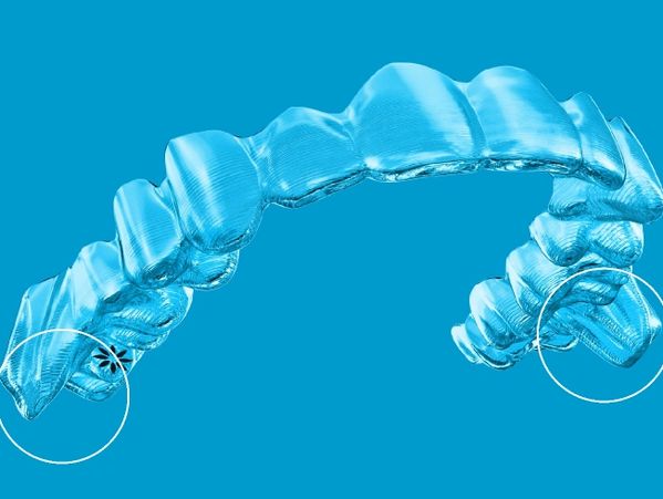 Is Invisalign Treatment Right For Me?