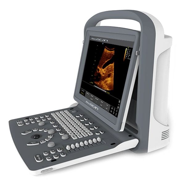Portable ultrasound machine displaying an abdominal scan on screen.