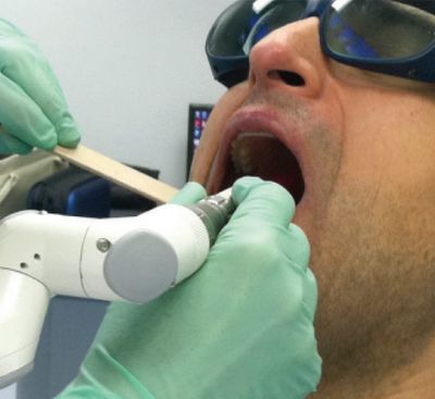 Laser used to reduce snoring