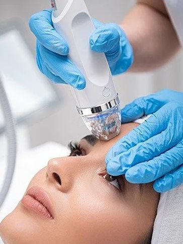 FRACTIONAL RF MICRONEEDLING 