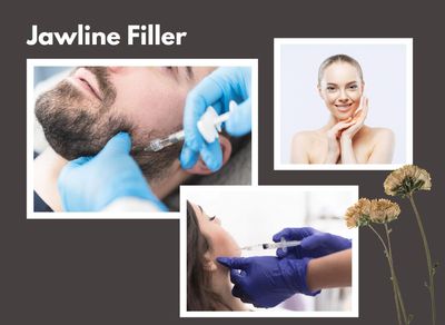 Jawline filler treatment with happy clients.