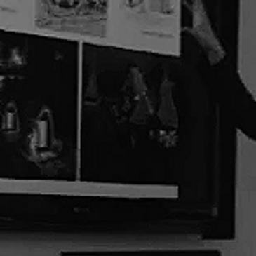 Person pointing at a presentation board with images and diagrams.