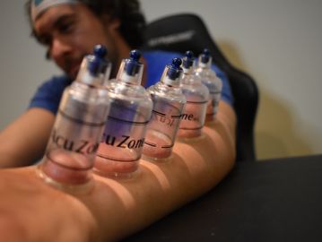 Cupping Therapy, Physical Therapy, Chiropractic, The Woodlands