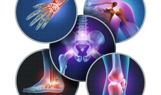 Orthopedic treatment
Arthritis treatment
