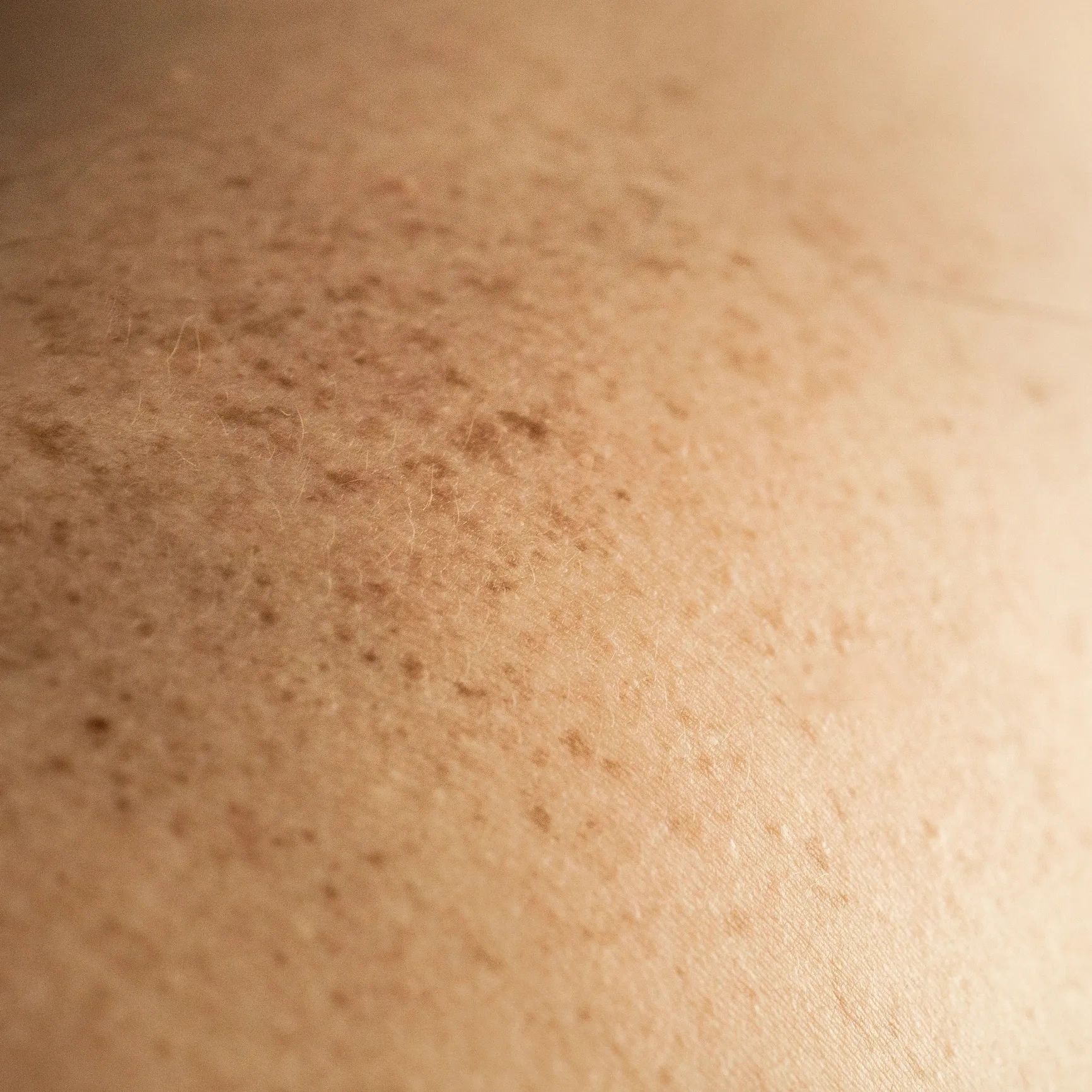 Close-up of skin with freckles and fine hairs visible.
