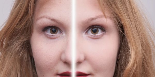 Split face showing natural skin on one side and airbrushed smooth skin on the other.