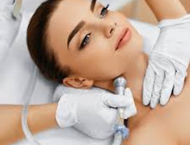  traitement de microdermabrasion, une technique d'exfoliation à la pointe de diamant.