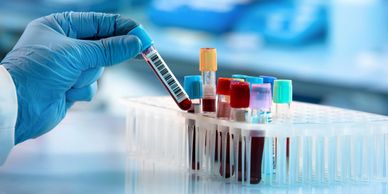 Gloved hand holding a blood sample tube with barcode in a lab.
