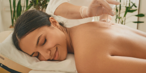 Smiling women receiving acupuncture on her back, Encino, California, the valley, 818, 91316