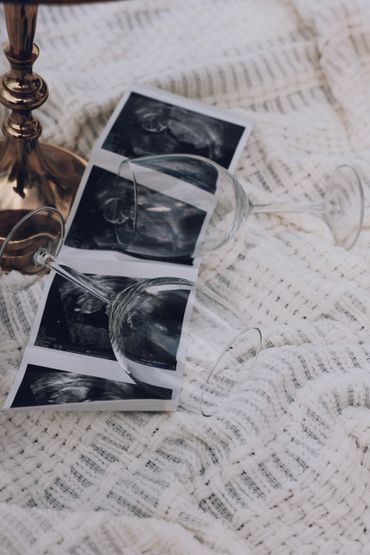 Ultrasound images with empty wine glasses on a textured blanket.