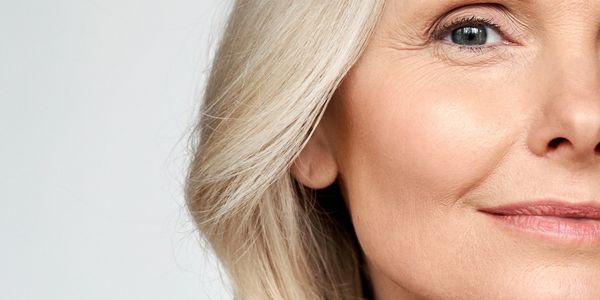Aesthetics botox fillers Profhilo Sunekos facials polynucleotides Biggleswade Potton Sandy Baldock.