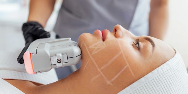 Beauty aesthetics HIFU Biggleswade Bedfordshire skin botox facials polynucleotides  microneedling 