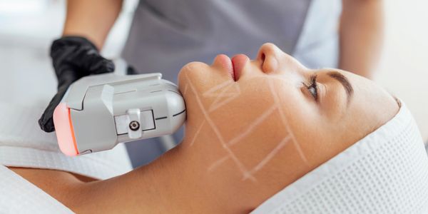 Aesthetics botox fillers Profhilo Sunekos facials polynucleotides Biggleswade Potton Sandy Baldock.