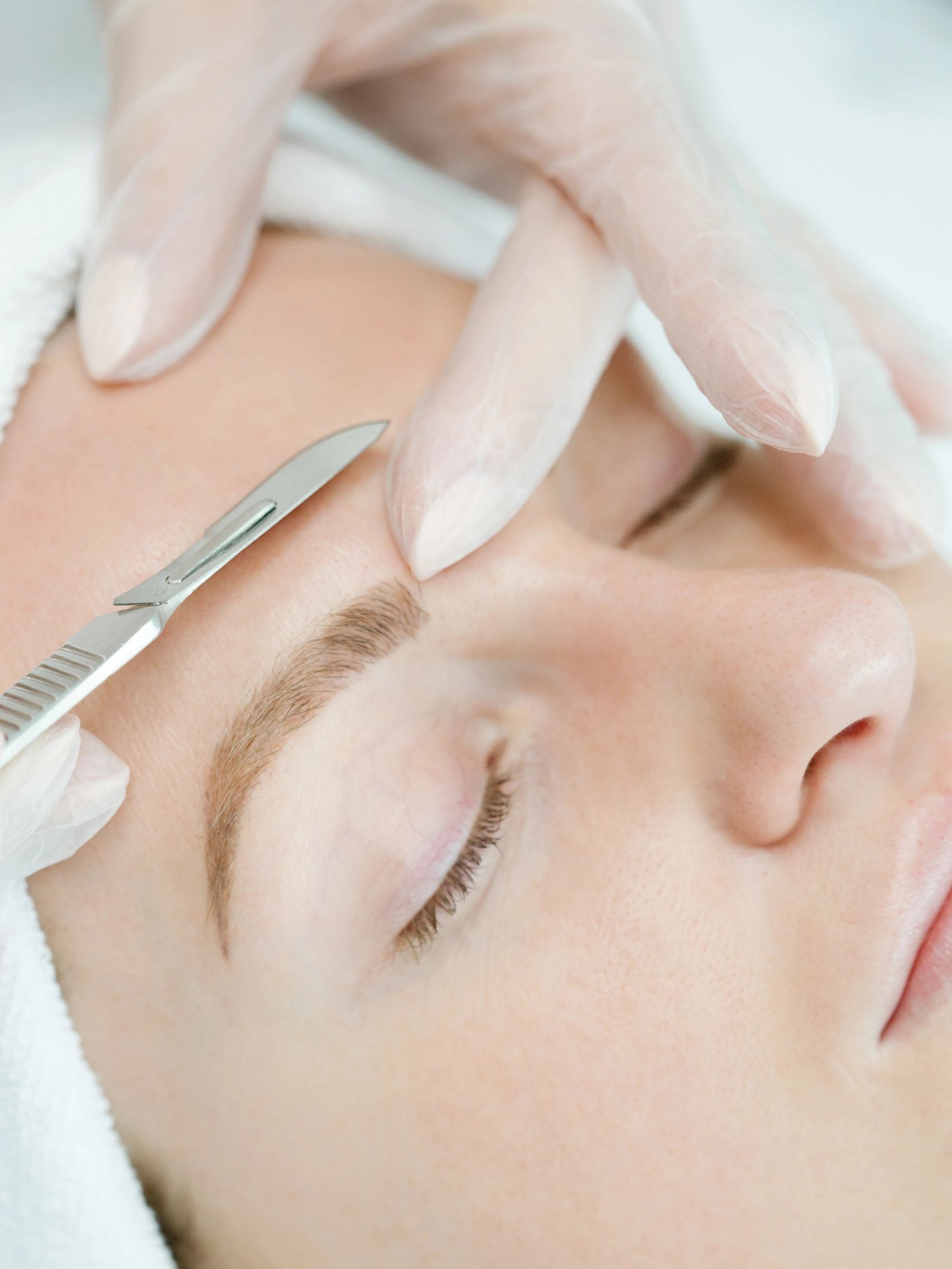 Dermaplaning in Calgary 