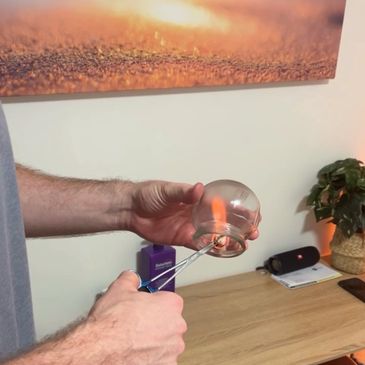 Mobile chiropractor Jack Worthington holding fire up to traditional Chinese glass cupping cups.