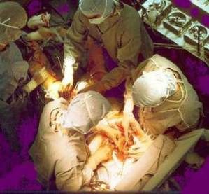 Coronary bypass surgery