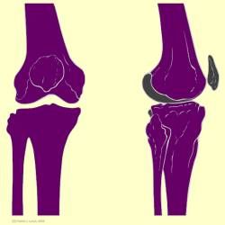 knees jeffrey dach md