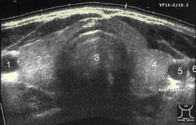 thyroid sonogram jeffrey dach md