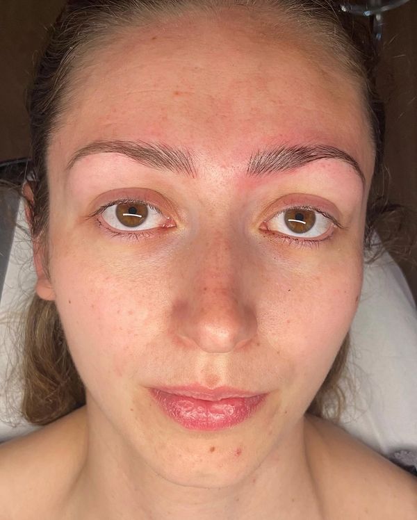 Microblading