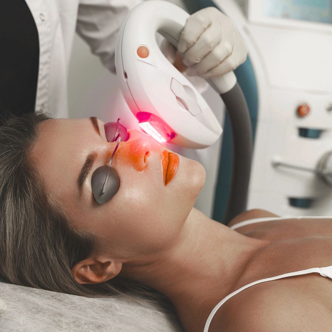 IPL Facial, Laser facial near me, anti-aging facial, acne facial, laser skin resurfacing, YAG facial